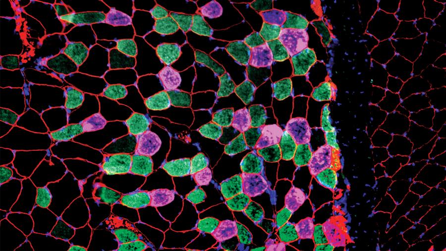 Muscle cells as seen under a microscope.